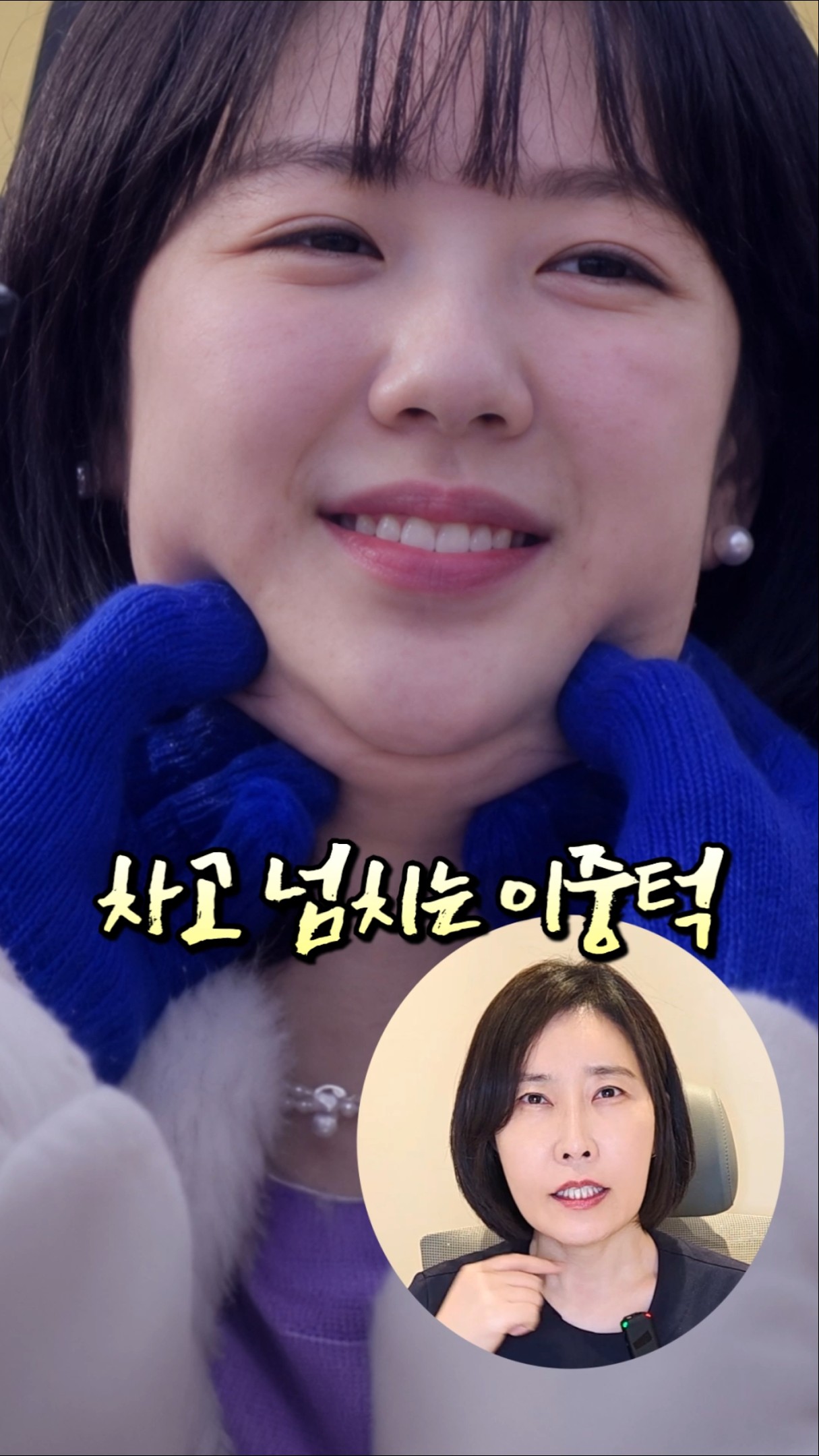 넘치는 이중턱과 팔뚝👀 여기에 올라온 승모근 없애는법‼️❓️