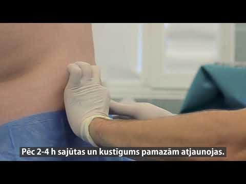 Video: Vispārēja Anestēzija Dzemdību Laikā Veselības Līnija