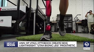 The U unveils world’s most advanced bionic leg