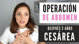 Operación en Abdomen tras una Cesárea 😯 ¿Por qué me operaron? ¿Es común tras una cesárea?