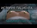 Теперь моя грудь лучше чем у сестры