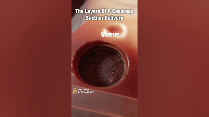 Layers of C-Section Delivery ✨FASCINATING✨ #shorts