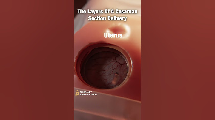 Layers of C-Section Delivery ✨FASCINATING✨ #shorts