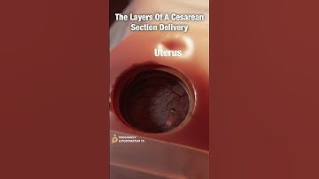 Layers of C-Section Delivery ✨FASCINATING✨ #shorts