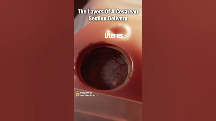 Layers of C-Section Delivery ✨FASCINATING✨ #shorts - DayDayNews