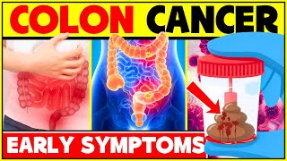 3 Early Signs And Symptoms Of Colon Cancer |  Warnings Signs Of Colorectal Cancer - Bowel Cancer