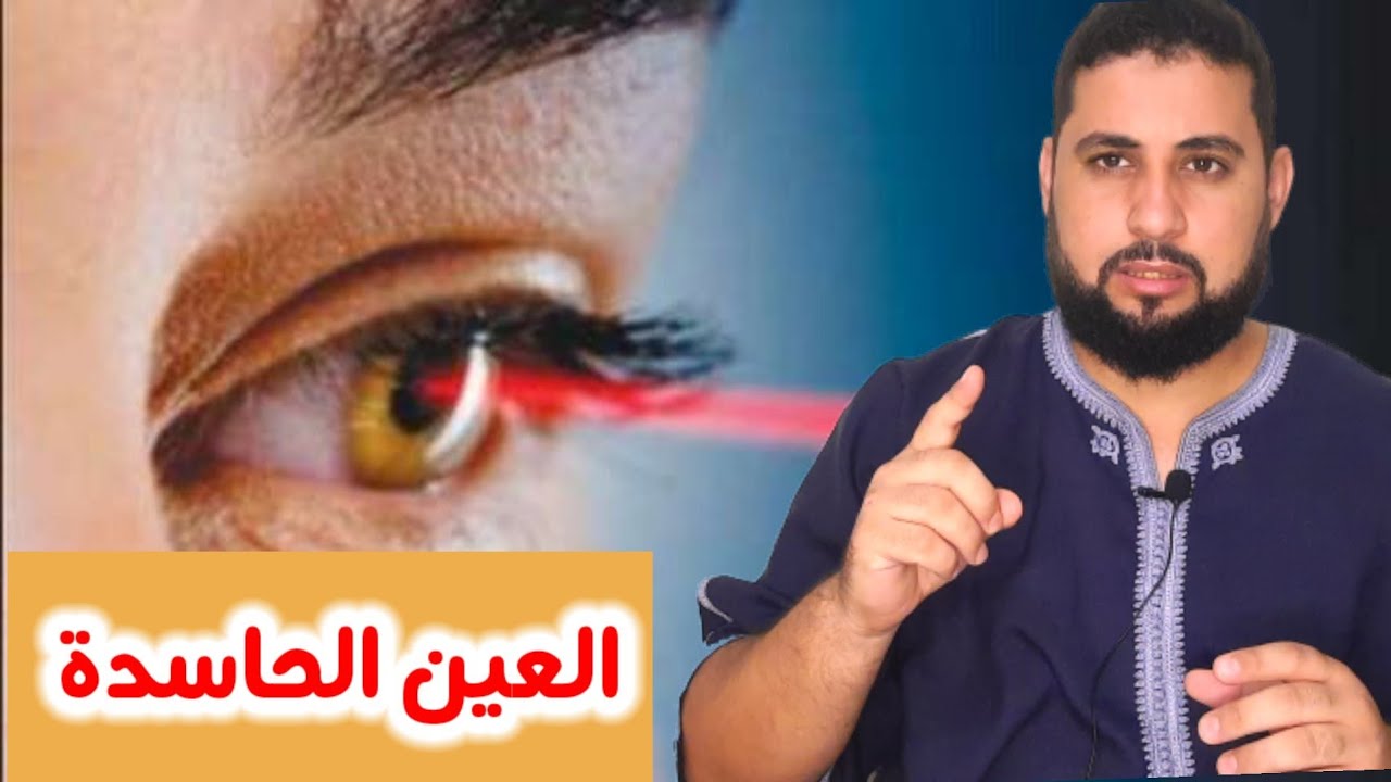 العين الحاسدة | محمد لعري | Mohamed laari
