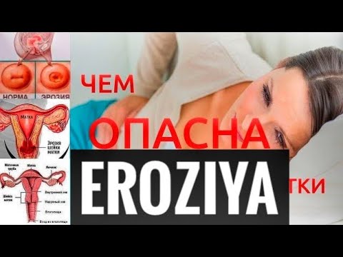 Video: Eroziya nimadan kelib chiqadi?