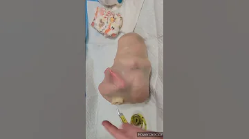 كيف يولد الطفل من بطن امه 
