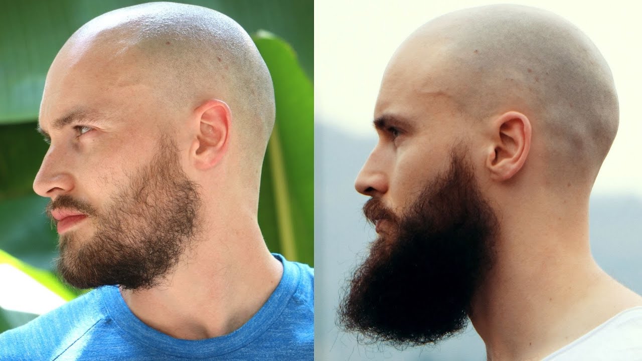 Thin Beard To Winning Beard And Back *My Entire Beard Journey* - YouTube