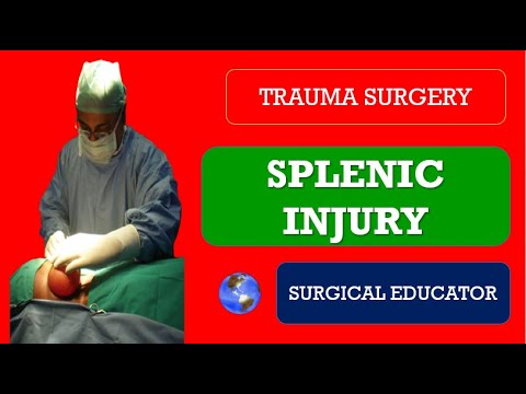 SPLENIC INJURY - How to DIAGNOSE & TREAT/Blunt Injury Abdomen / Trauma Surgery