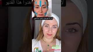 بوتوكس طبيعي لشد تجاعيد بين الحاجبين    #shorts #faceliftmassage