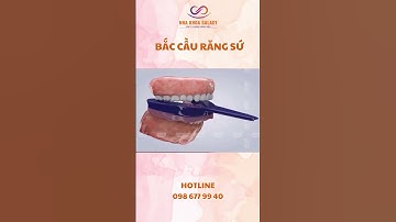 Bắc cầu răng sứ là giải pháp quen thuộc để thay thế răng mất trong một số trường hợp  #nhakhoagalaxy
