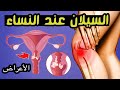 أعراض مرض السيلان عند النساء