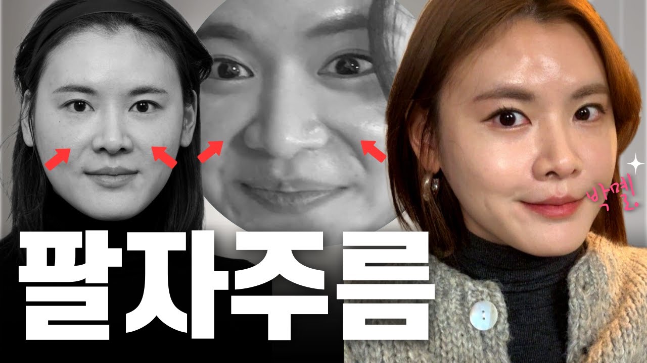 30대 팔자주름 실리프팅, 보톡스, 필러ㅣ상담과정, 필수질문, 시술과정, 일차별 후기