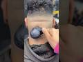 ازالة الحبايه المتسلطنة من القفا       