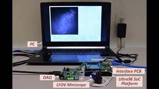 Live Demo: Real-Time Calcium Trace Extraction from Large-Field-of-View Miniscope (IEEE BioCAS'21)