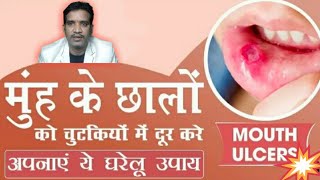 मुंह के छालों (Mouth ulcers) को चुटकियों में दूर करे अपनाएं ये घरेलू उपाय | Ayurvedic Mantra Ramdev