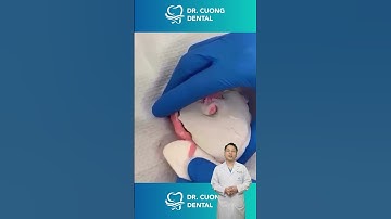 Lấy khuôn răng sẽ như thế nào | Bác sĩ Cường