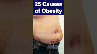 causesofobesity Obesity Overweight Motapa Viral video