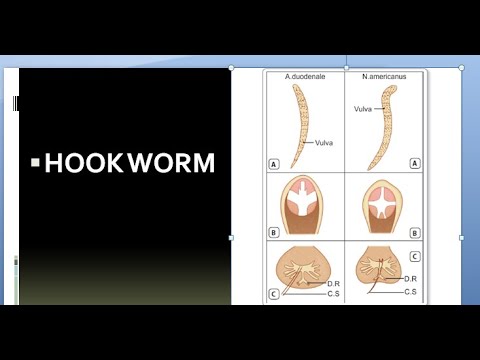 Parasitology 200 a Hookworm,ancylostoma duodenale,necator americanus