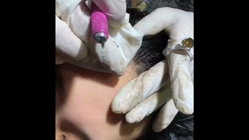 Điêu Khắc Sợi Tóc #proteamsmp #smpvietnam #xamtochoi #scalptattoo#saigontattoogroup