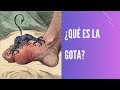 ¿Qué es la Gota?