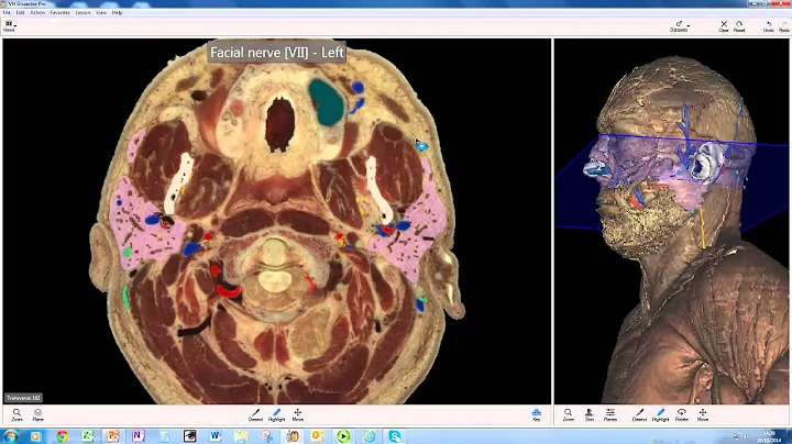 VHD PAROTID TEST default