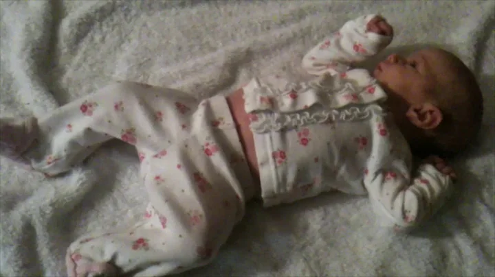 AIMS Evaluation 0 to 3 Months Observation Case 6 1