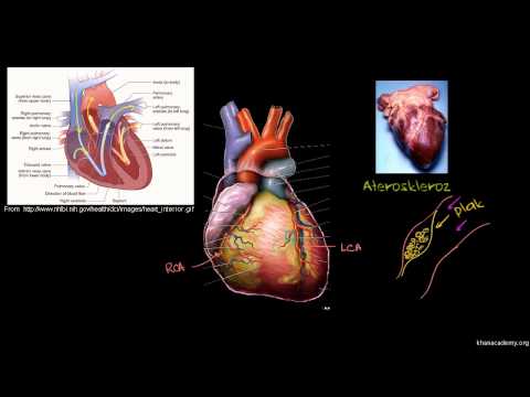 Kalp Hastalıkları ve Kalp Krizi (Sağlık: Çeşitli Konular)