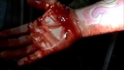 Scrub Python Attack - Bite