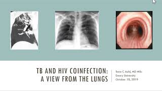 October 18th, 2019: HIV/TB Inter-CFAR Working Group Webinar