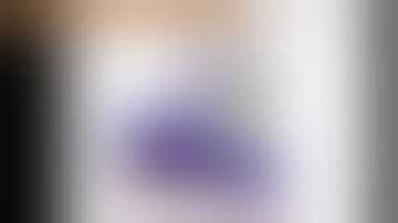 Robotic-assisted partial nephrectomy (with 3D-reconstruction and augmented reality)