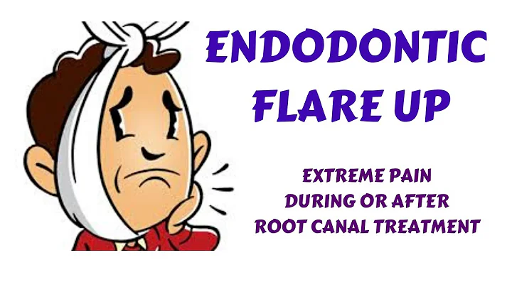 Understanding and Managing Flare-ups in Root Canal Treatment