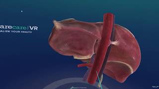 Sharecare VR 간liver