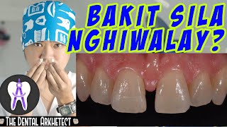 Gaps Between Your Teeth? Here Are Some Possible Reasons #36 #Diastema #Gaps