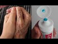 40+ Simple Hand Whitening | Skin Whitening Remedy | Madam diy