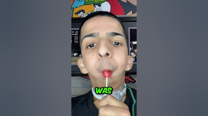 Born Without a Chin, But Found His Voice 🎤