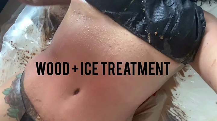 Cryotherapy + Wood and Ice treatments. | Post Opp ...