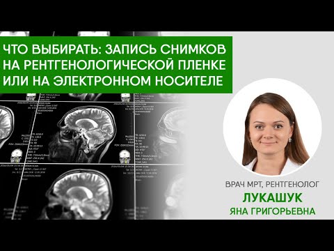 Все о МРТ процедуре - что выбрать запись МРТ на снимках или диске