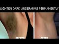 Result In Just 30 minutes Dark Underarm and private parts Whitening 100% Works I