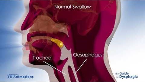Guide To Dysphagia   3D Animations of Swallowing360p 1