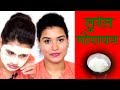 Home Remedy for Fair and Glowing Skin (Hindi)