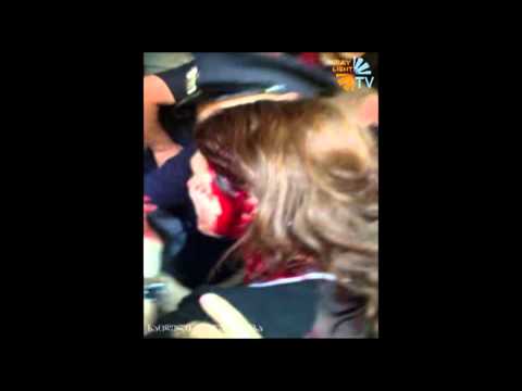 ვაჩნაძის ქუჩაზე მომხდარი ინციდენტის დროს რადიო ფორტუნას ჟურნალისტს თავი გაუტეხეს