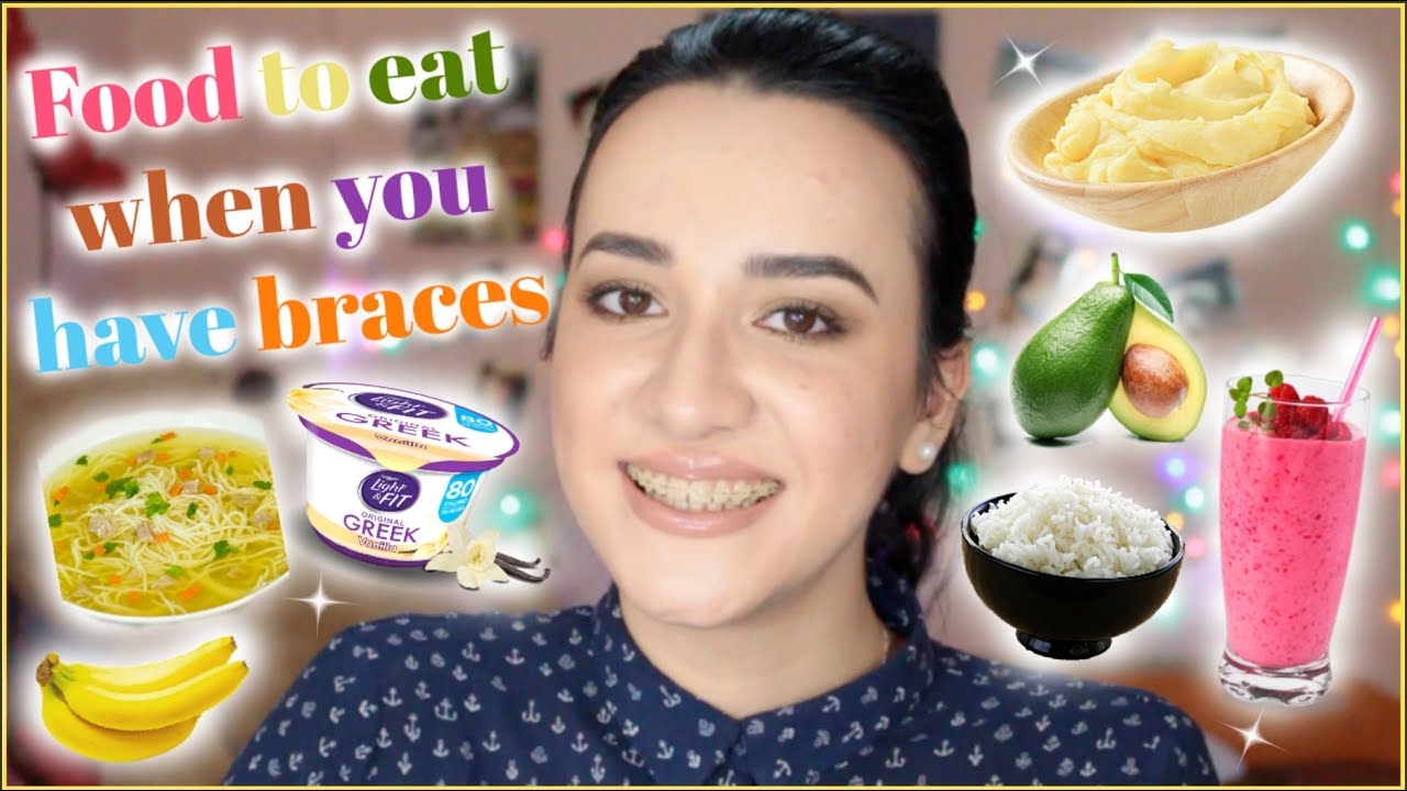 ENG: Food To Eat When You First Get Braces | What to eat when you have ...