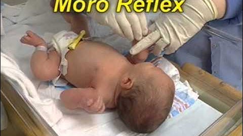 Motor Skills: Reflexes HQ