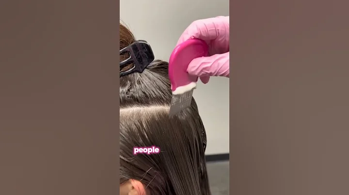 This much lice even after pesticide treatments. #shorts #youtubeshorts #hair #lice #bug #fyp #reels