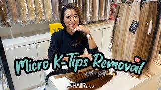 Tips And Trick For Micro K-Tips Removal