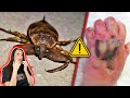 Most DANGEROUS Bugs In The World!