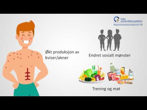 08/10 Tegn og symptomer på helseskadelig bruk av anabole-androgene steroider